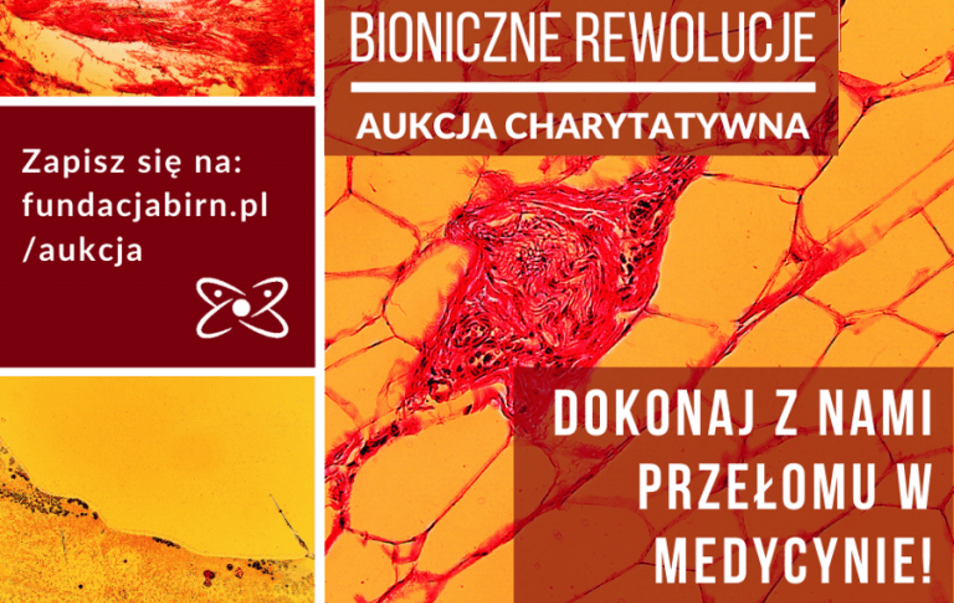 Aukcja charytatywna „Bioniczne rewolucje” już 12 marca w Warszawie!